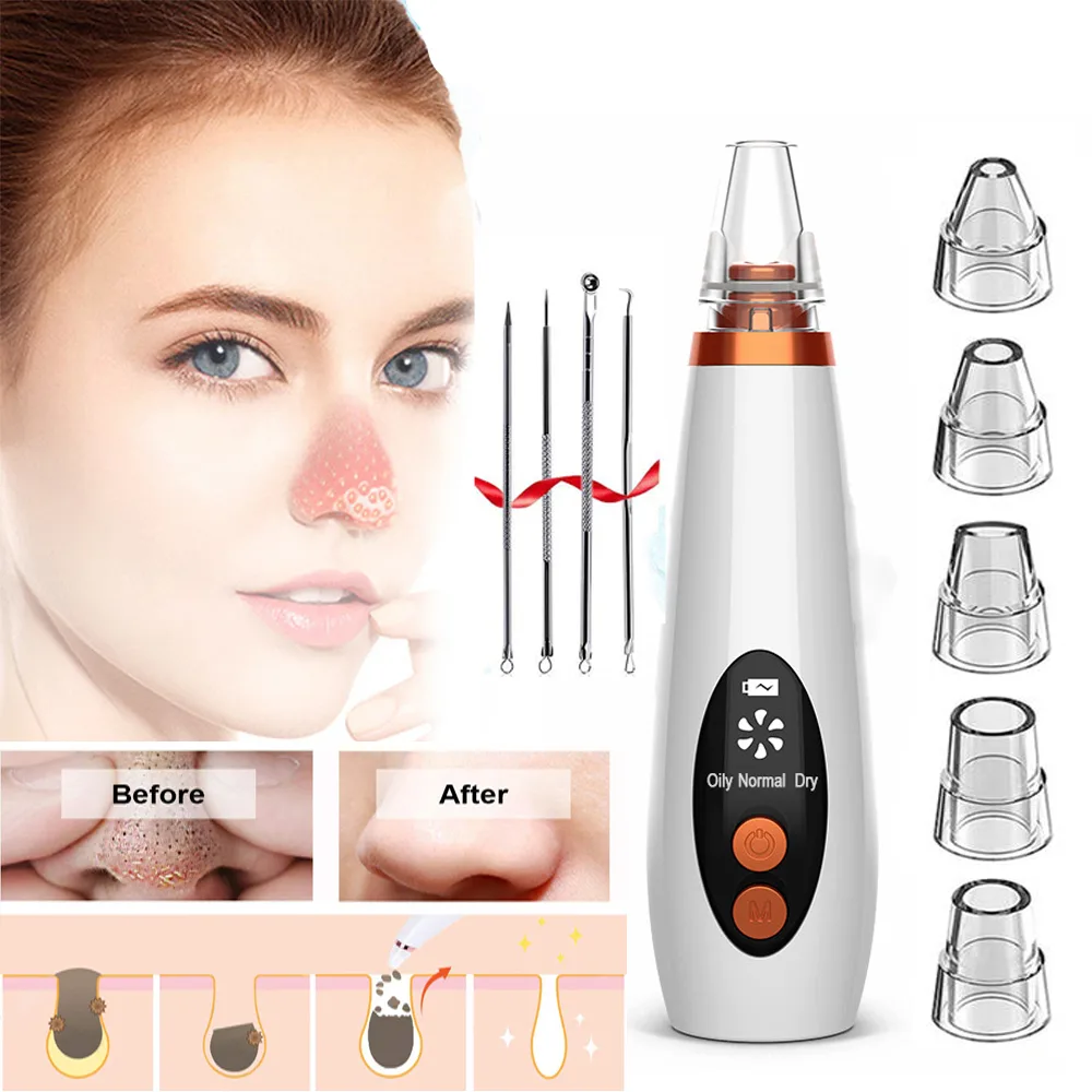 TROPRO TROPRO 3 Speeds Electric Blackhead Remover Skin Care Device — product photo