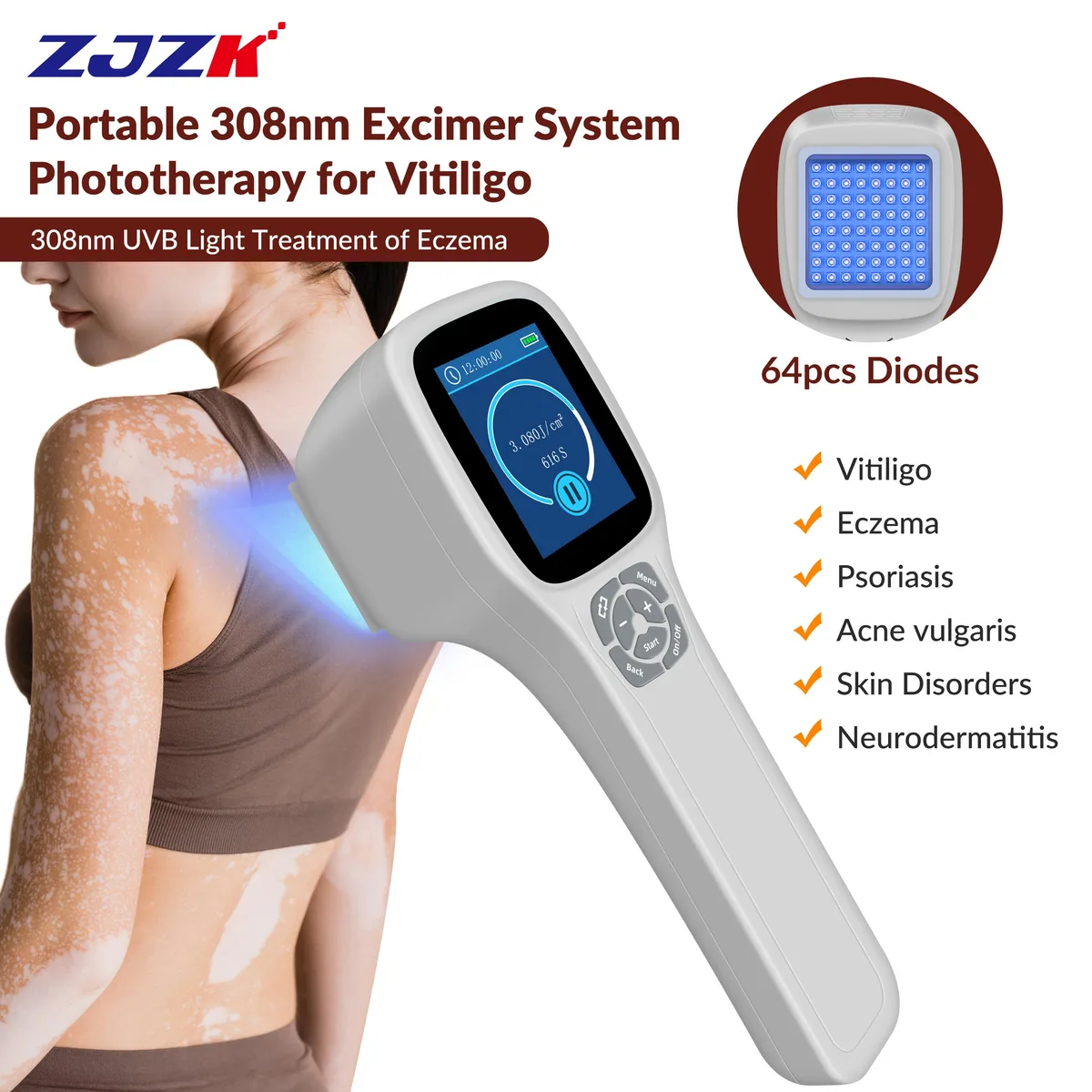 ZJZK ZJZK PD01-A 308nm UVB Phototherapy Lamp 64 Diodes 46x46mm 3400mAh 0.48kg home health care — product photo