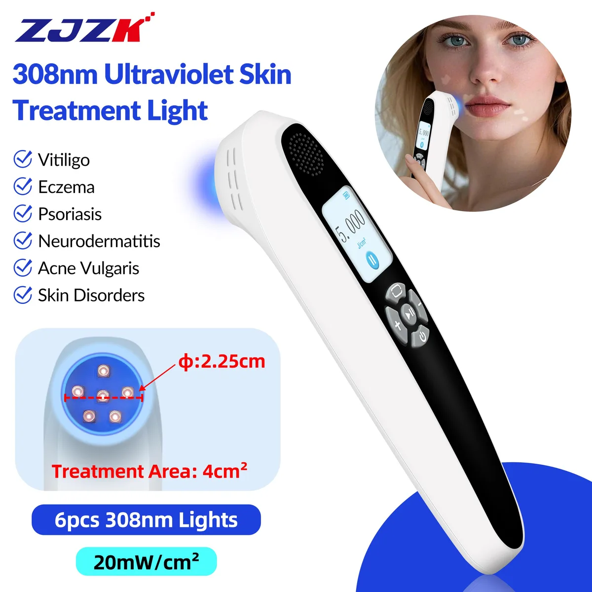 ZJZK ZJZK PD02W20 308nm UVB Phototherapy Device 20mW/cm² 0-5J/cm² home health care — product photo