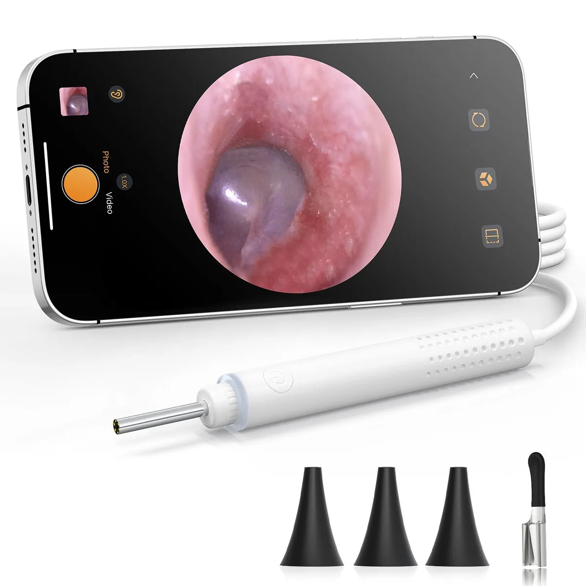  ScopeAround SASA39i USB-C Otoscope 720P 2x 3.9mm Black — product photo