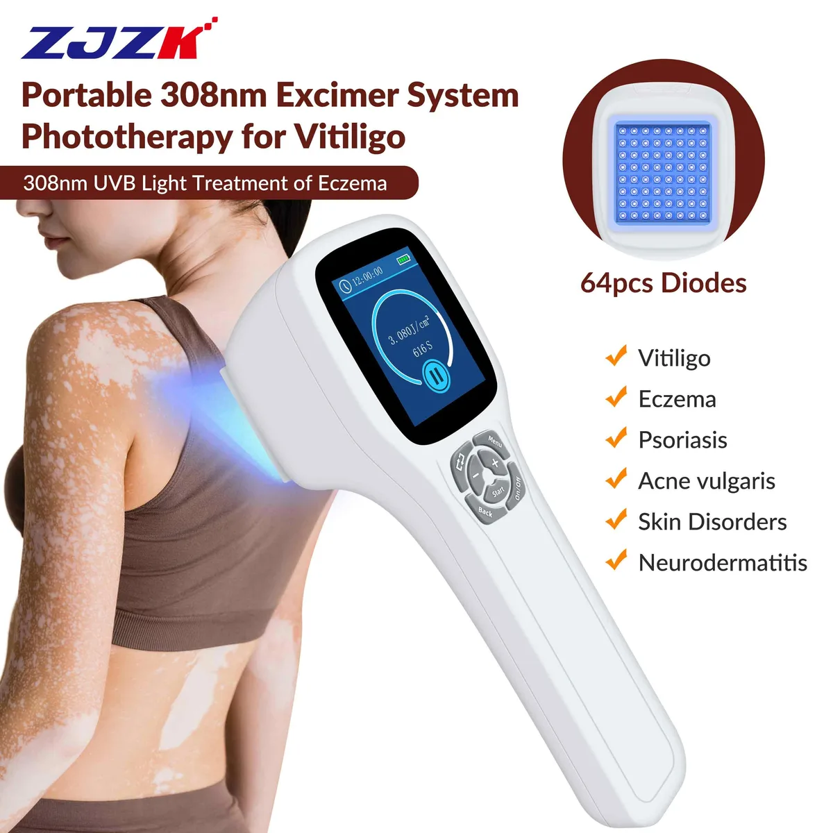 ZJZK ZJZK PD01-A 308nm UVB Phototherapy Lamp 64 diodes 46x46mm 3400mAh 0.48kg — product photo