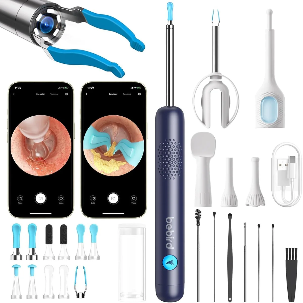 Blue handheld ear camera with tweezers and multiple tips
