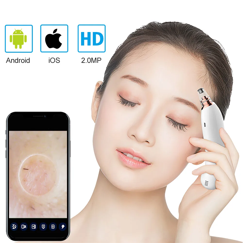 ECbidbuy ECbidbuy Smart Wireless WiFi Blackhead Meter White 1.5cm 800mAH — product photo