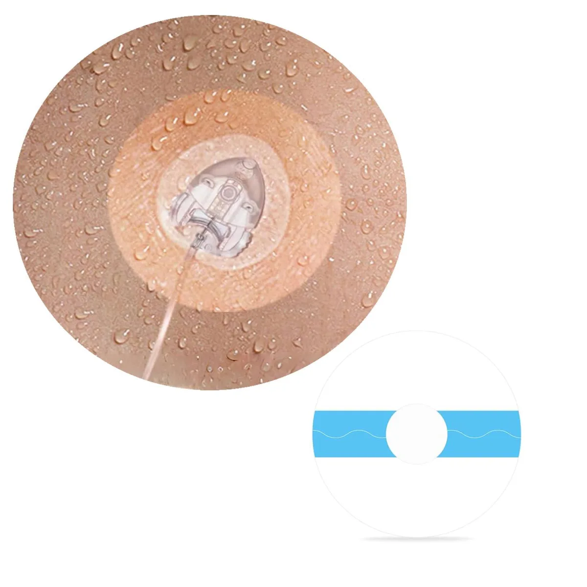 XILETIGOHA 25 Pack Universal CGM Adhesive Patches 0.8-Inch Hole — product photo