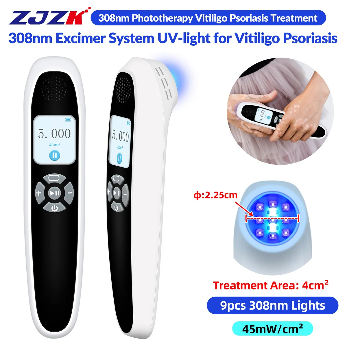 ZJZK ZJZK PD02W45 308nm UVB Phototherapy Home Health Care 45mW/cm² 1800mAh — product photo