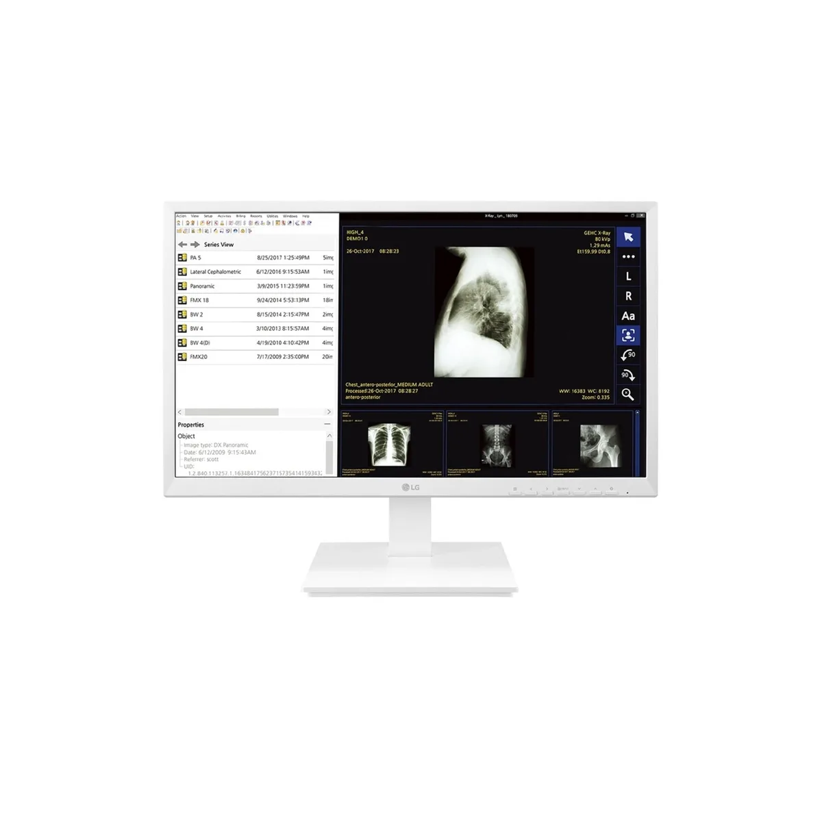 LG Electronics LG Thin Client 24CK560N-3A 24" 4GB 32GB AMD GX-212JJ AI edge system — product photo